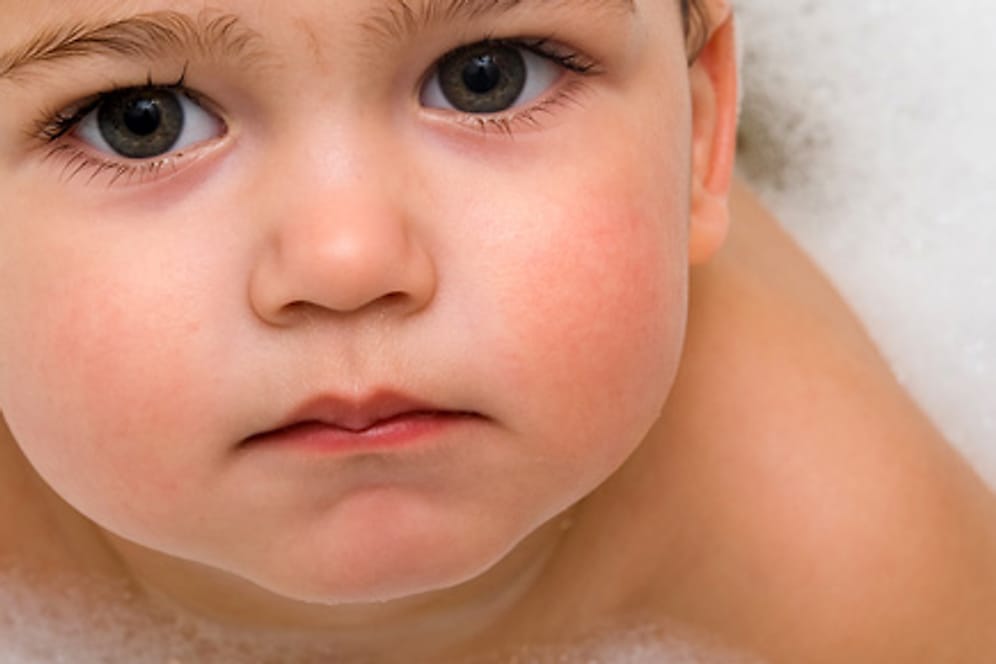 Zu häufiges Baden kann die Haut des Kindes austrocknen.