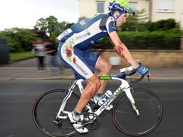 Sturzfolgen: Imanol Erviti machte auf der sechsten Etappe unliebsame Bekanntschaft mit der Straße. Vor allem eine Knieverletzung, bei der auch Muskeln betroffen waren, sorgte dafür, dass der Spanier nicht zum siebten Teilstück startete.