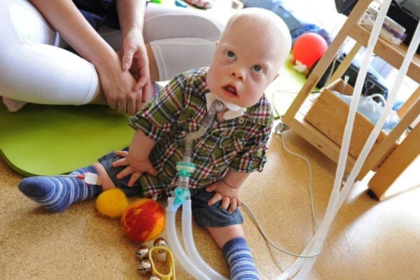 Der kleine Tim spielt in der Arche Regenbogen. Hier werden dauerbeatmete Kinder in familiärer Umgebung betreut.