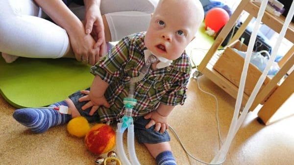 Der kleine Tim spielt in der Arche Regenbogen. Hier werden dauerbeatmete Kinder in familiärer Umgebung betreut.