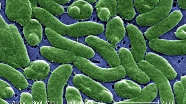 Elektronenmikroskopische Aufnahme von Vibrio vulnificus, einem Erreger der Wundinfektionen, Durchfall und Blutvergiftungen hervorruft