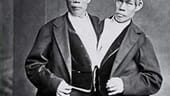 Später wanderte das Brüderpaar in die USA aus. Dort heirateten sie die Schwestern Adelaide und Sarah Yates, mit denen sie zusammen 21 Kinder hatten. Chang und Eng Bunker starben 1874 innerhalb weniger Stunden im Alter von 63 Jahren.