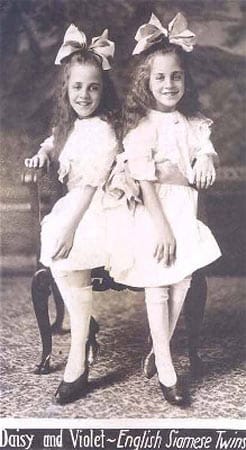 Daisy und Violet Hilton wurden 1908 in England geboren. Die Mädchen waren an Po und Hüfte zusammengewachsen. Ähnlich wie die Bunker-Brüder wurden auch sie in aller Welt als Sensation vorgeführt. Auch Daisy und Violet wanderten in die USA aus, und versuchten ihr Glück mit wechselndem im Showgeschäft. 1969 starben sie verarmt in einem Wohnwagen