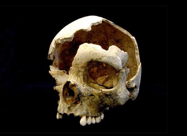 Der Schädel einer 18 bis 22 Jahre alten Frau aus der Jungsteinzeit: Die Frau wurde um das Jahr 3600 vor Christus in der Blätterhöhle bestattet. Der Schädel einer 18 bis 22 Jahre alten Frau aus der Jungsteinzeit: Die Frau wurde um das Jahr 3600 vor Christus in der Blätterhöhle bestattet.