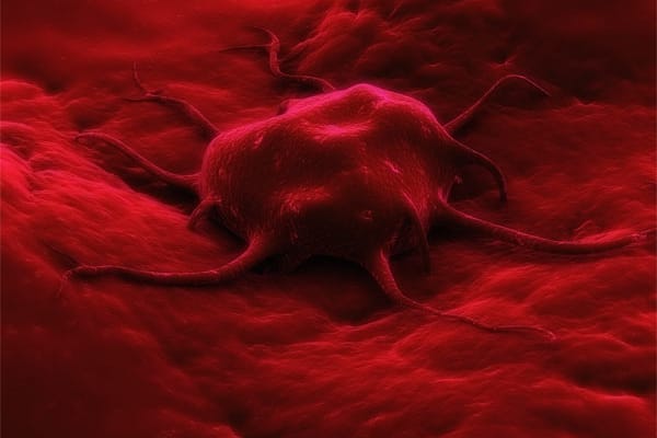 Chemotherapie kann laut Forschern Krebszellen beim Überleben helfen