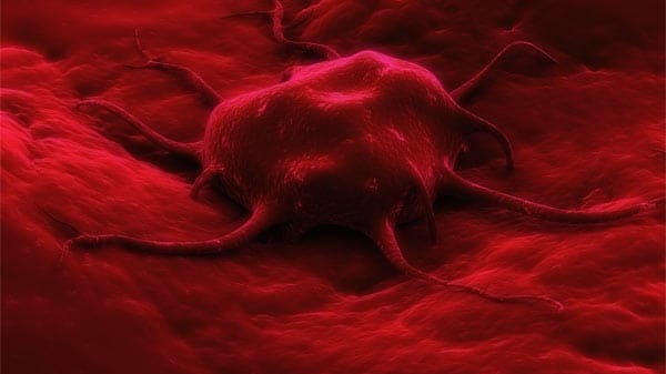 Chemotherapie kann laut Forschern Krebszellen beim Überleben helfen Chemotherapie kann laut Forschern Krebszellen beim Überleben helfen