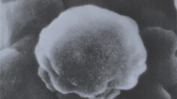 Tödliches HI-Virus: Seit Aids 1981 als eigenständige Krankheit anerkannt ist, sind mehr als 30 Millionen Menschen an der Immunschwächekrankheit gestorben. Die Buchstaben stehen für "Acquired Immune Deficiency Syndrome" (englisch für "erworbenes Immundefektsyndrom").