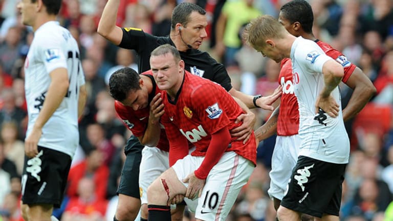 Wayne Rooney zieht sich im Punktspiel von Manchester United gegen den FC Fulham eine tiefe Schnittwunde am Oberschenkel zu.