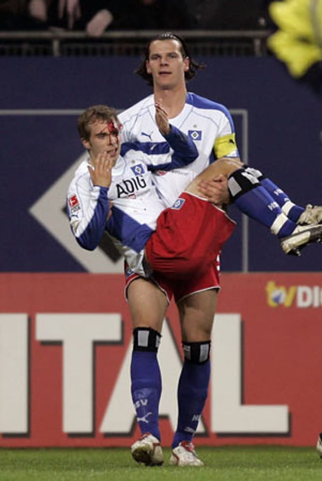 Im März 2005 wird Alexander Laas beim Spiel des HSV von einem Trommelstock aus dem Kölner Fanblock getroffen. Daniel van Buyten trägt seinen Mannschaftskameraden anschließend vom Spielfeld.