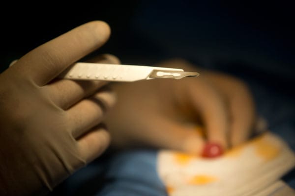Der Urologe Aref El-Seweifi hält in einer Berliner Privatklinik bei einer Beschneidung an einem zweijährigen Jungen das Skalpell.