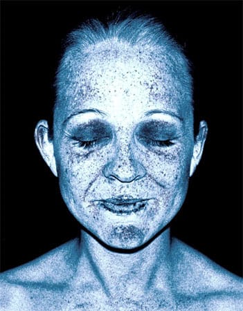 Scanner zeigt Hautschäden durch UV-Strahlen.
