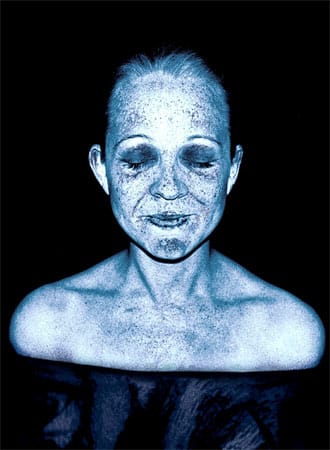 Scanner zeigt Hautschäden durch UV-Strahlen.