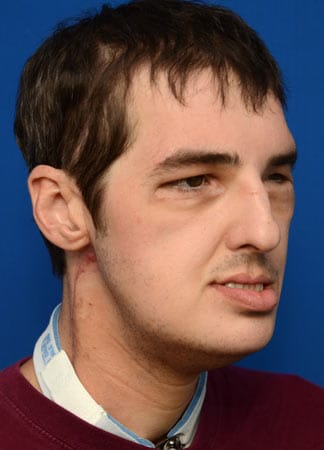 Gesundheit: Doch mittlerweile sieht Noris wieder aus wie ein ganz gewöhnlicher Mann Ende Dreißig - für ihn ist das ein Geschenk. Gesundheit: Doch mittlerweile sieht Noris wieder aus wie ein ganz gewöhnlicher Mann Ende Dreißig - für ihn ist das ein Geschenk.