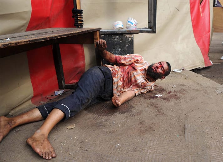 Ein verwundeter Demonstrant liegt am Boden. Angeblich schossen die Sicherheitskräfte mit Schnellfeuergewehren auf die Muslimbrüder, Scharfschützen feuerten von den Dächern.
