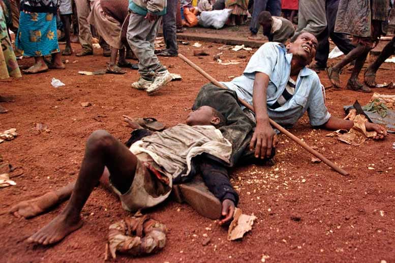 Auf der Flucht sterben und leiden die Menschen. Das gilt auch für die gemäßigten Hutu, die Opfer ihrer eigenen Leute sind. Dieser Mann und das Kind haben sich die Beine gebrochen. Im Flüchtlingslager Goma war es am 16. November 1996 zu Ausschreitungen und Kämpfen um die viel zu knappen Nahrungsmittel gekommen.