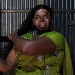 Farida (40) kommt aus Bangladesch. Mit 24 Jahren drohte sie ihrem drogenabhängigen und spielsüchtigen Mann, ihn zu verlassen. Nachts schüttete er Säure über sie und verriegelte die Tür. Seitdem wurde sie 17 Mal operiert.