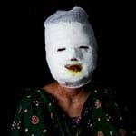 Apis Gesicht und Kopf sind dick bandagiert. Die 19 Jahre alte Frau aus Bangladesch ließ sich von ihrem Mann scheiden. Eines Nachts kam dann die neue Frau ihres Ex-Mannes und schüttete Säure auf ihren Hals. Als Api aus dem Krankenhaus entlassen worden war, griff die Frau sie noch einmal an.