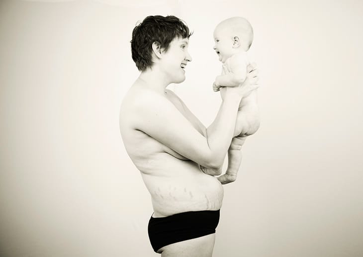 Aja Whelan-Schrapel mit ihrer fünf Monate alten Tochter Autumn Claire. Aja möchte ihrer Tochter beibringen, dass sie schön, stark und frei ist - egal wie sie aussieht.