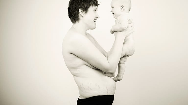 Aja Whelan-Schrapel mit ihrer fünf Monate alten Tochter Autumn Claire. Aja möchte ihrer Tochter beibringen, dass sie schön, stark und frei ist - egal wie sie aussieht.
