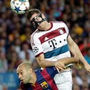 Bayern-Stürmer Robert Lewandowski lässt sich von seiner Gesichtsmaske nicht behindern und geht mutig in Zweikämpfe und Kopfballduelle.