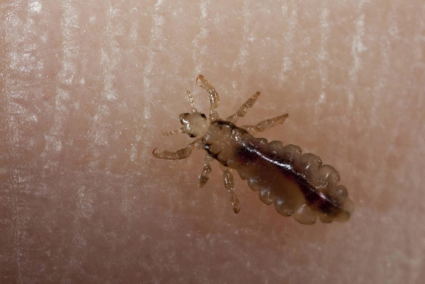 Parasiten Unter Der Haut Beim Menschen www.t-online.de