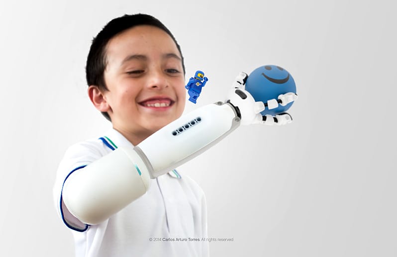Kinder können die von Torres entwickelte Arm-Prothese fast beliebig mit Bausteinen und Figuren von Lego umgestalten.