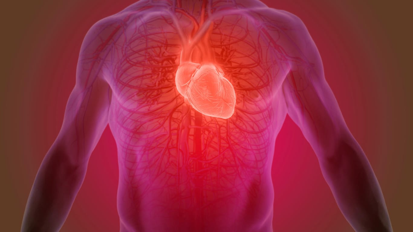 Herzinfarkt: Schmerzen, die bei einem Herzinfarkt auftreten, können bis in den Oberbauch ausstrahlen.