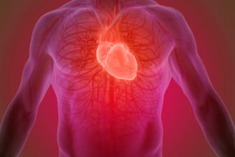 Herzinfarkt: Schmerzen, die bei einem Herzinfarkt auftreten, können bis in den Oberbauch ausstrahlen.