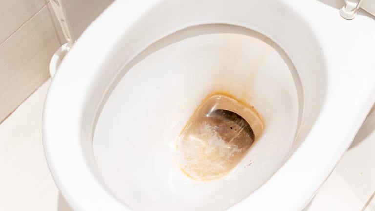 Toilette: Urinstein riecht unangenehm und sieht ebenso unansehnlich aus.