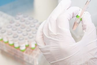 Eine biologisch-technische Assistentin bereitet PCR-Tests auf das Corona-Virus von Patienten im PCR-Labor vom Niedersächsischen Landesgesundheitsamt (NLGA) für die Analyse vor.