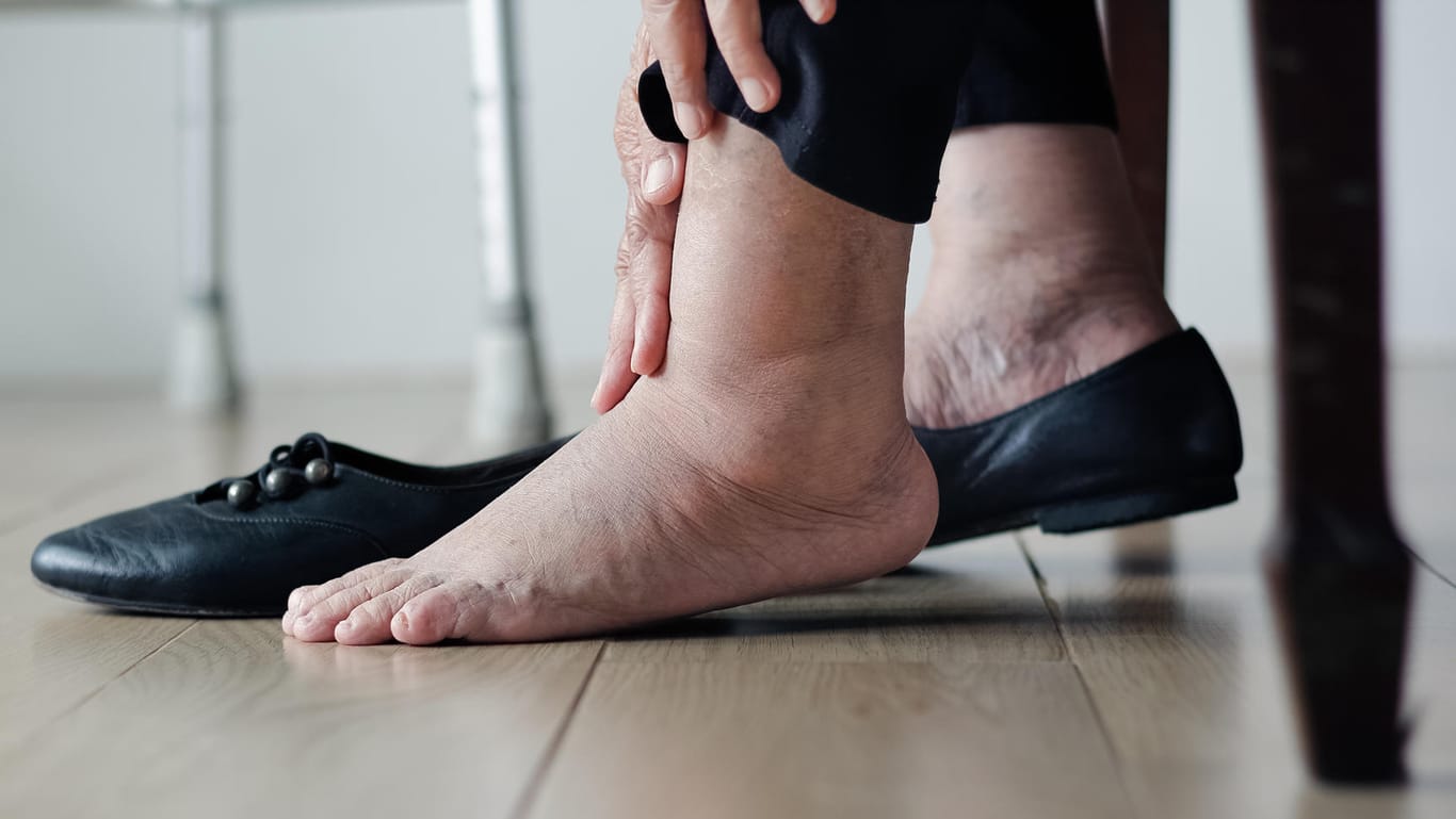 Swollen ankles (symbolic image): They can cause pain.