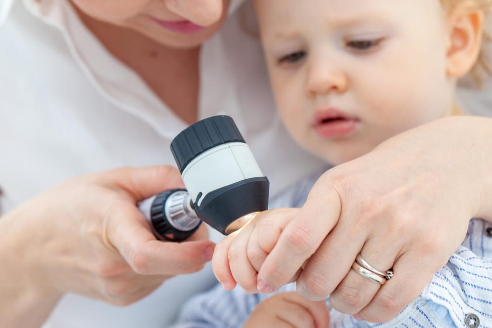 Eine Ärztin untersucht die Hand eines Kleinkinds mit einem Dermatoskop