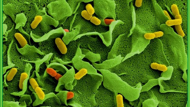Elektronenmikroskopische Aufnahmen von Listerien (Listeria monocytogenes) auf der Oberfläche einer dendritischen Zelle. Elektronenmikroskopische Aufnahmen von Listerien (Listeria monocytogenes) auf der Oberfläche einer dendritischen Zelle.