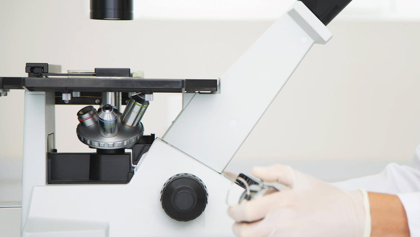 Im Labor wird eine Probe unter einem Mikroskop untersucht (Symbolbild): Auf diese Weise fand Marthe Gautier eine Unregelmäßigkeit bei Kindern mit Downsyndrom.