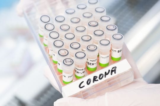 Gefäß mit aufbereiteten PCR-Tests auf das Coronavirus