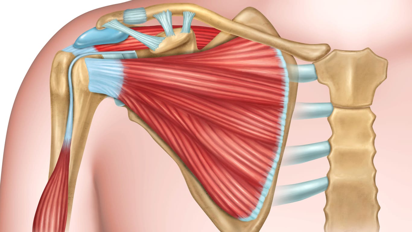 In den vier Sehnen der Rotatorenmanschette sammelt sich häufig Kalk an. Die dazugehörigen Muskeln entspringen am Schulterblatt und vereinigen sich in ihrem sehnigen Ansatz am Oberarmkopf.