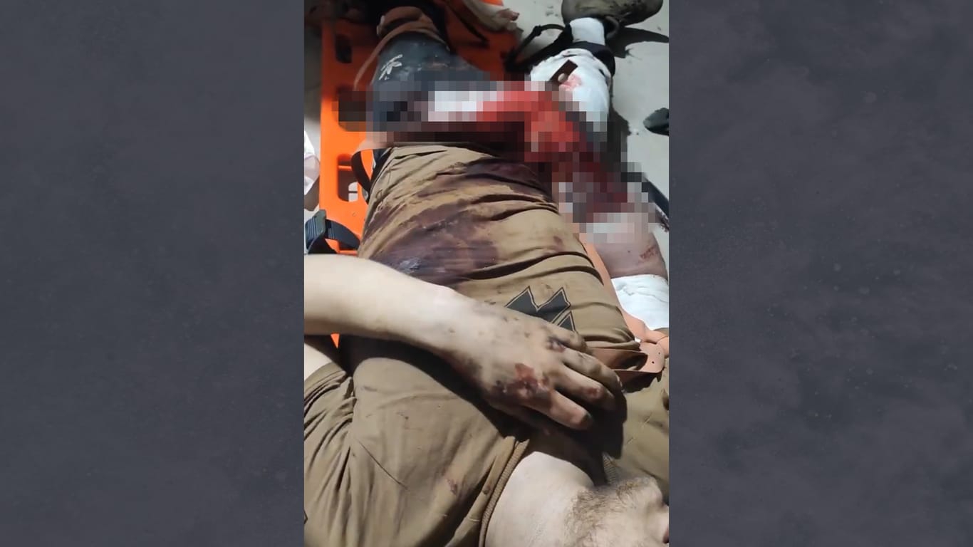 Das Bild zeigt laut dem Bürgermeister von Mariupol einen verwundeten Soldaten des Asow-Regiments, der Menschen aus dem Stahlwerk retten wollte.