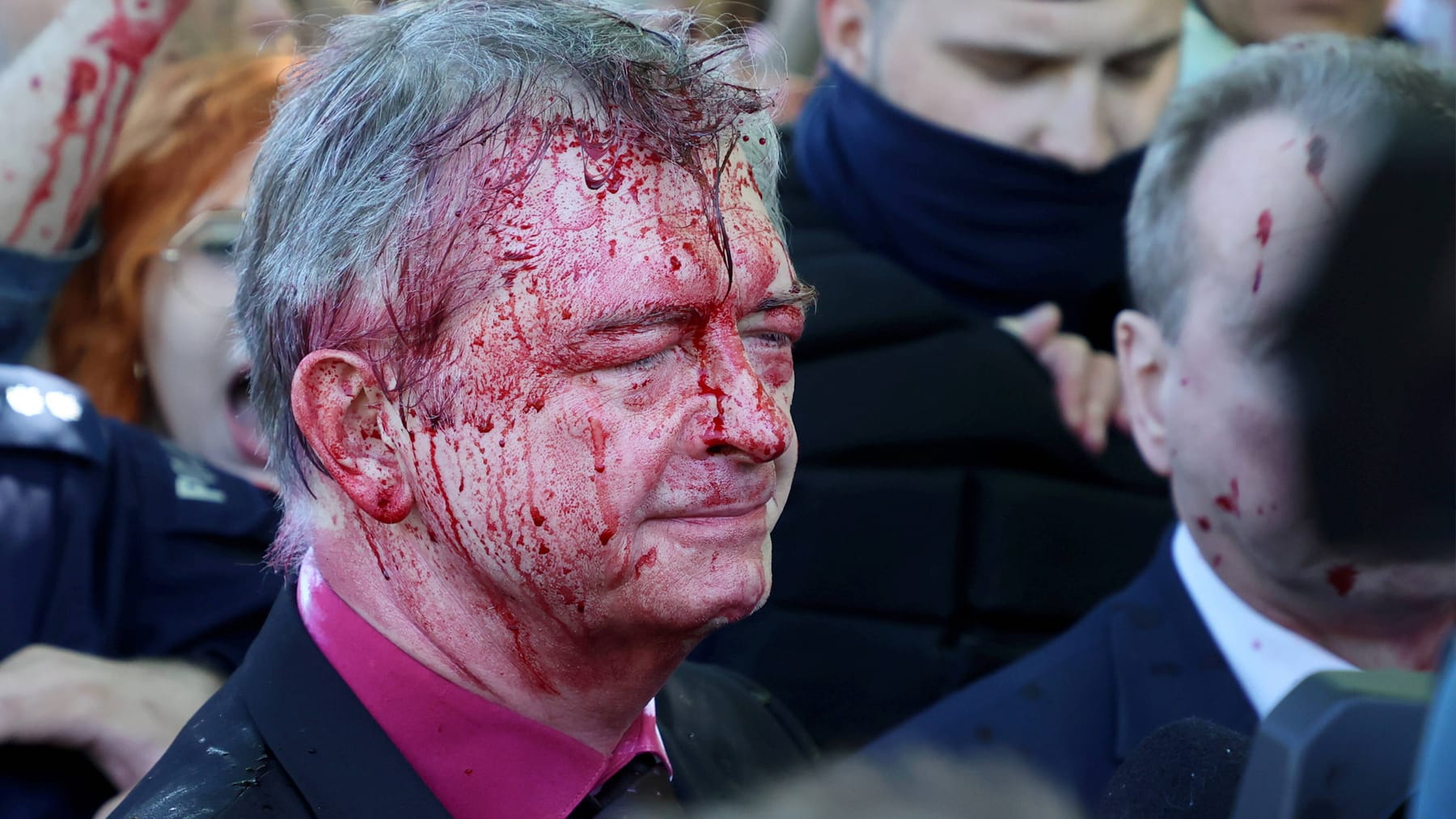 Rosyjski ambasador spryskuje protestujących farbą