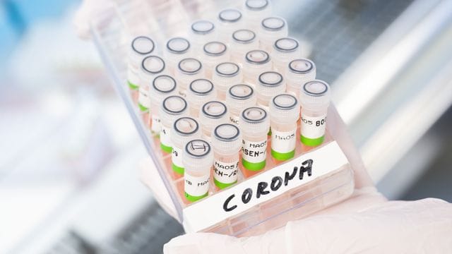 Gefäß mit aufbereiteten PCR-Tests auf das Coronavirus