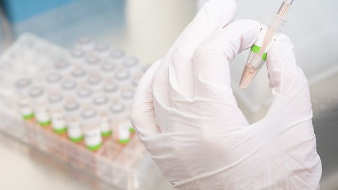 Eine biologisch-technische Assistentin bereitet PCR-Tests vor