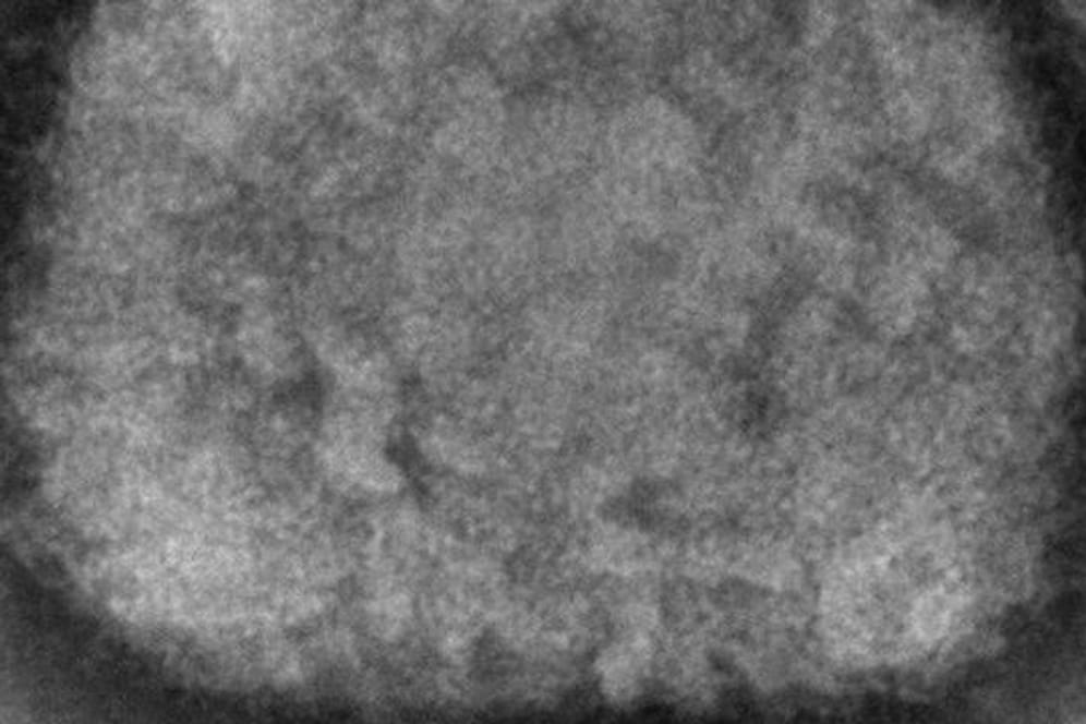 Diese elektronenmikroskopische Aufnahme zeigt ein Affenpockenvirus.