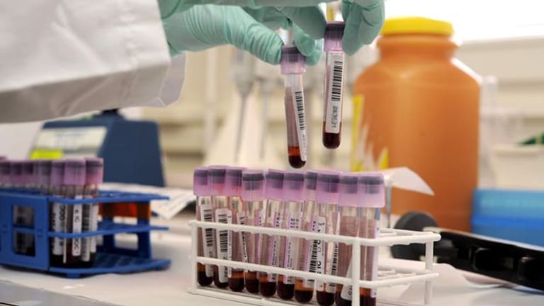 Ein Assitent sortiert in einem Labor für Dopingkontrollen Blutproben.