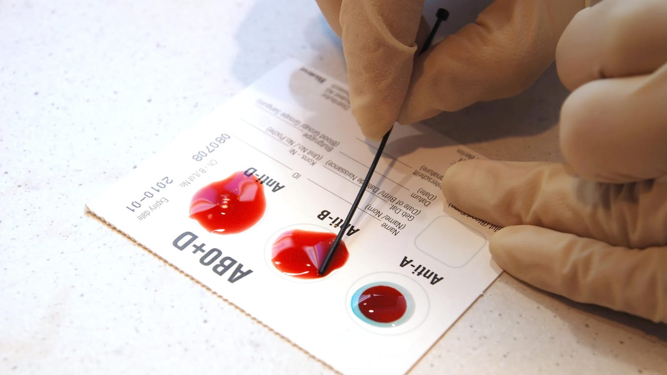 Test zur Blutgruppenbestimmung (Symbolbild): Mit einem Pikser in den Finger können Sie zu Hause Ihre Blutgruppe erfahren.