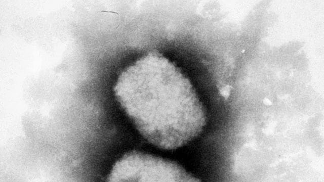 Nach dem Auftreten erster Fälle von Affenpocken in Deutschland sehen Fachärzte keine neue Pandemie aufziehen.