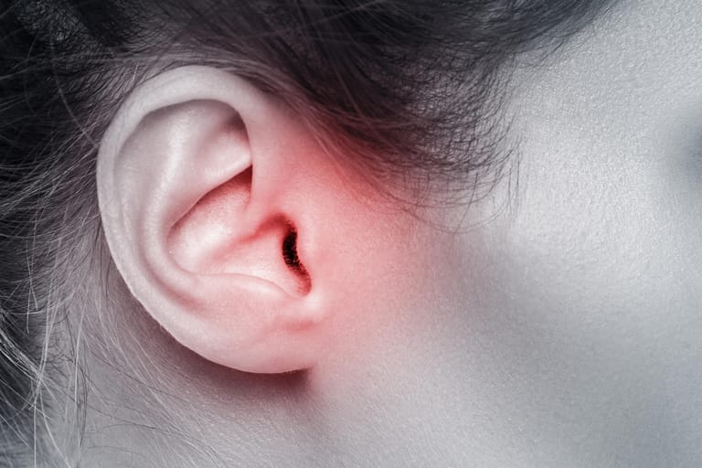 Illustration weibliches schmerzendes Ohr: Eine Mittelohrentzündung ist oftmals die Folge einer viralen Infektion und heilt meistens danach wieder ab. Wird diese chronisch kann das Trommelfell oder auch der Hörnerv in Mitleidenschaft gezogen werden. Unter anderem können Hirnhaut- oder Nervenentzündungen die Ursache einer Schwerhörigkeit sein.