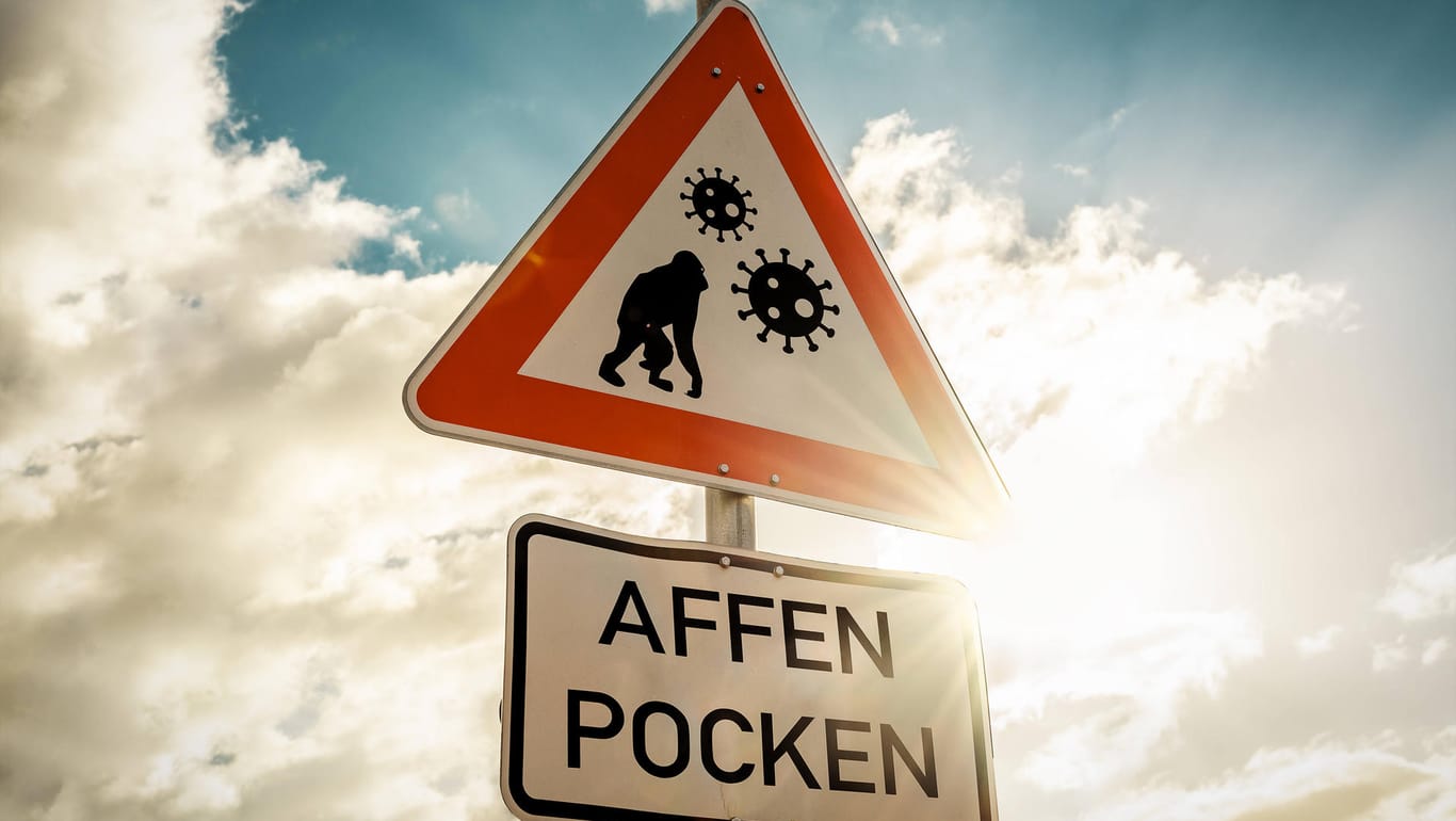 Ein Schild warnt vor Affenpocken (Symbolbild): Mit drei bestätigten Fällen ist das Virus jetzt auch in Köln angekommen.