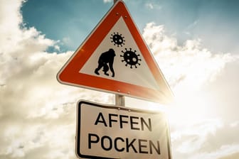 Ein Schild warnt vor Affenpocken (Symbolbild): Mit drei bestätigten Fällen ist das Virus jetzt auch in Köln angekommen.