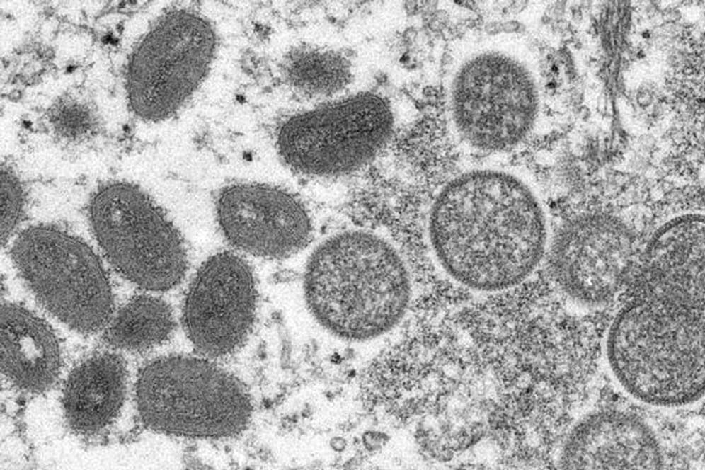 Eine elektronenmikroskopische Aufnahme zeigt reife, ovale Affenpockenviren (l) und kugelförmige unreife Virionen (r).