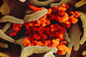 Corona-Infizierte geben das Virus Sars-CoV-2 hauptsächlich durch virushaltige Partikel weiter, die unter anderem beim Atmen, Husten und Sprechen entstehen.