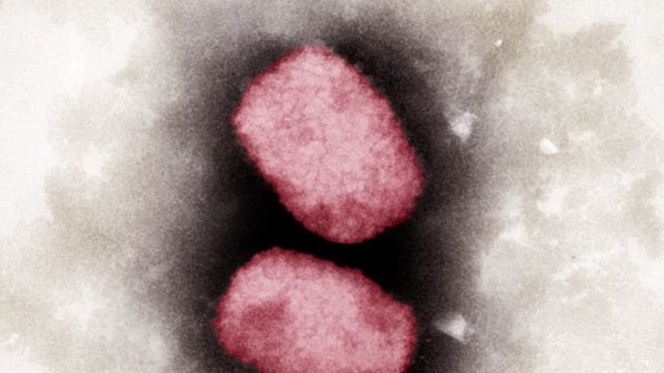 Elektronenmikroskopische Aufnahme von Affenpocken-Viren (Symbolbild): In neun deutschen Bundesländern wurden bisher Infektionen gemeldet.